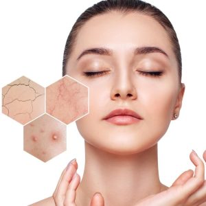 SENSITIVE SKIN