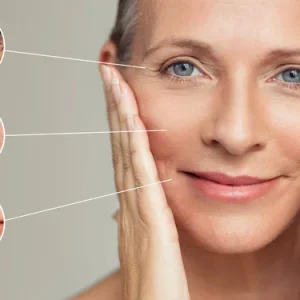 SKIN AGING